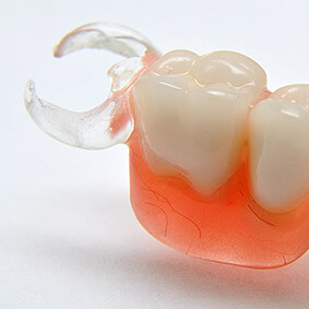 proteza acronowa tczew, uzupełnienia protetyczne, tczew dentysta protezy proteza elastyczna, dentu
