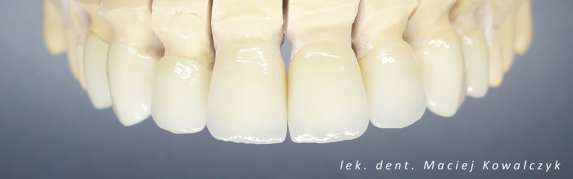 Implanty zębów Tczew